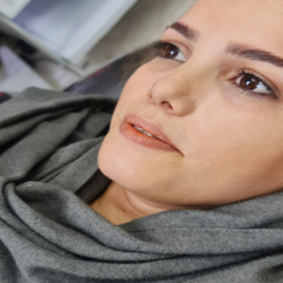 فیلر لب